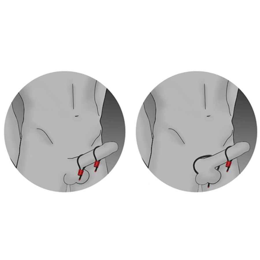 ELECTRASTIM - ANÉIS PENIANOS AJUSTÁVEIS PRESTIGE ELECTRA LOOPS VERMELHOS